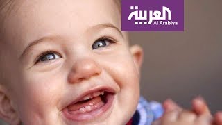 صباح العربية: ما هو سبب تأخر ظهور أسنان الأطفال؟