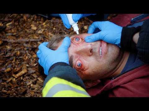 Scary Prank Gone Wrong: His Eyes Popped!