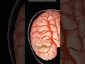 Embolectomy and thromboectomy Explained! #docs #doctor #medical #medicalstudent #medicaleducation