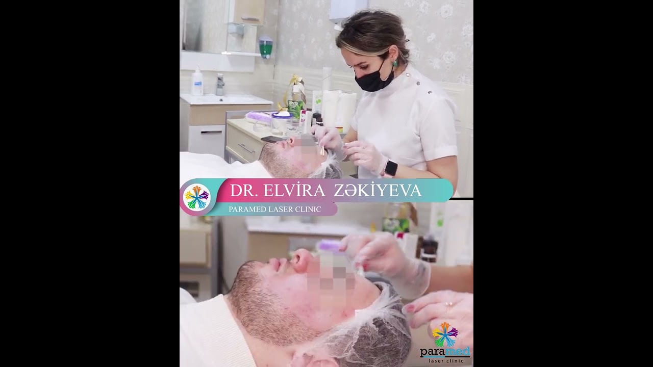 Пилинг Джесснера