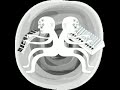 Aphex Twin - Melodies from Mars