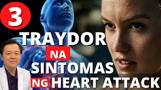 3 Traydor na Sintomas ng Heart Attack - Tips by Doc Willie Ong