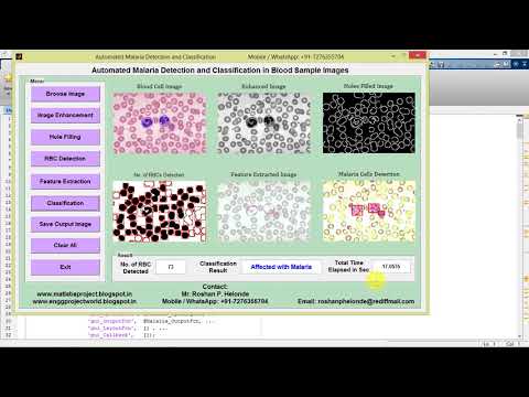 Malaria Parasite Detection and Classification in Blood Sample Images Using Matlab Project Code