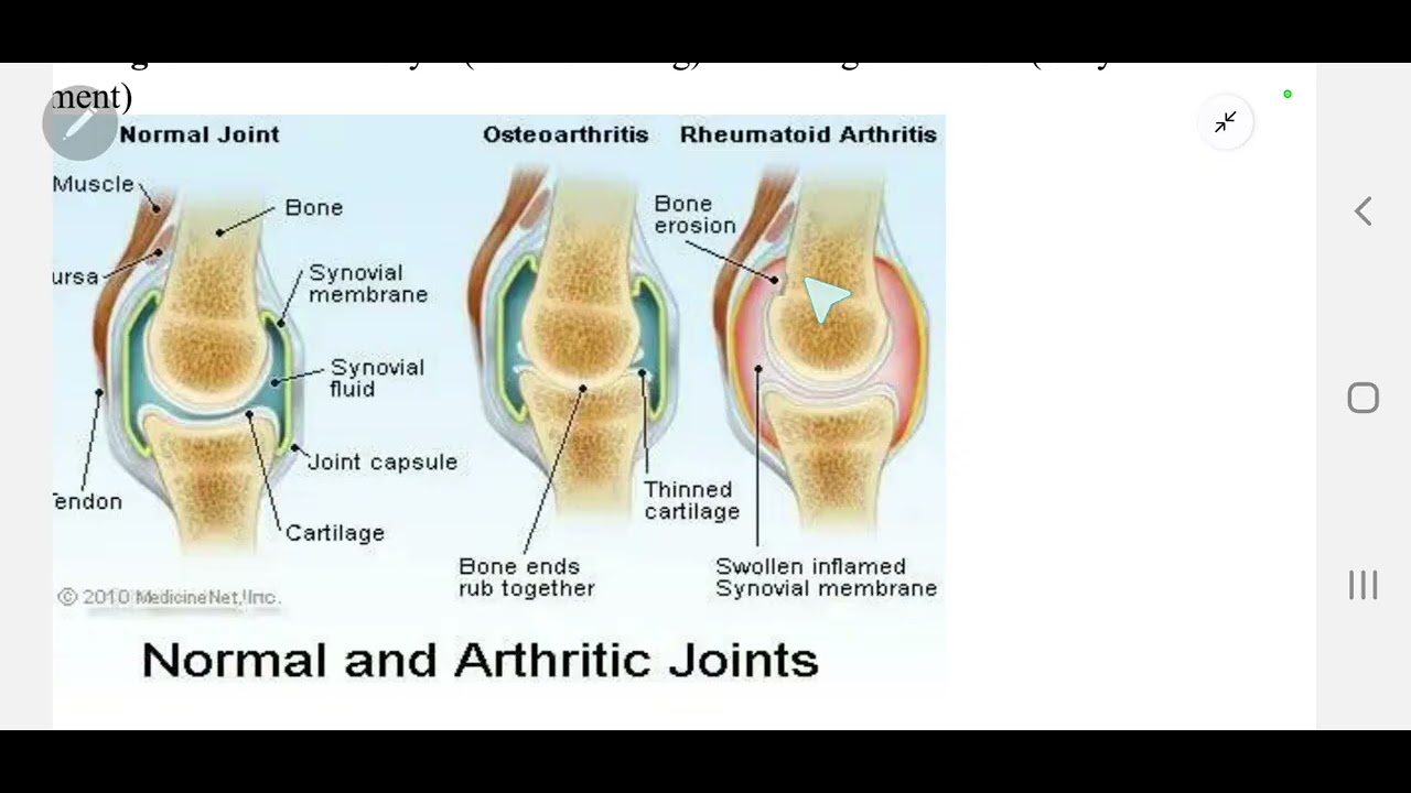 Introduction to rheumatic diseases 