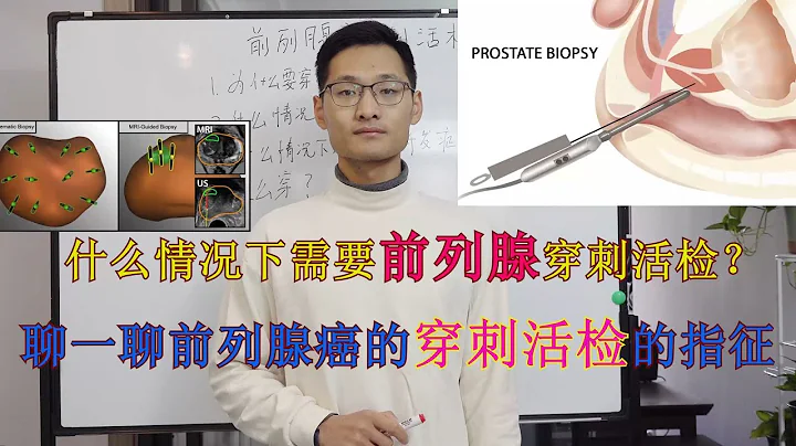 [Prostate cancer] The final verdict of prostate cancer-prostate biopsy - 天天要聞