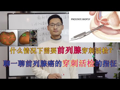 [Prostate cancer] The final verdict of prostate cancer-prostate biopsy
