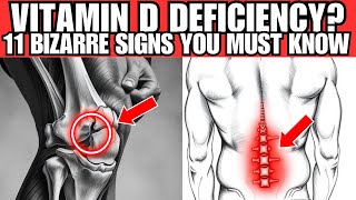 DON'T MISS THESE 11 BIZARRE SYMPTOMS OF VITAMIN D DEFICIENCY – IT COULD SAVE YOUR LIFE!