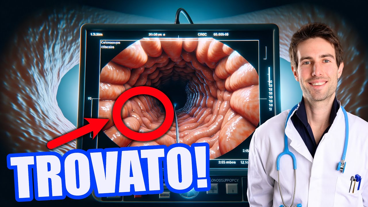 PREVIENI così il TUMORE del colon-retto ✅ Strategie di diagnosi precoce da un Medico Oncologo