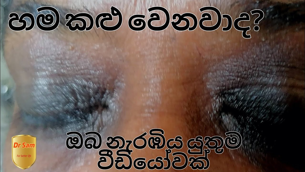 real-cause-for-darkening-of-the-skin