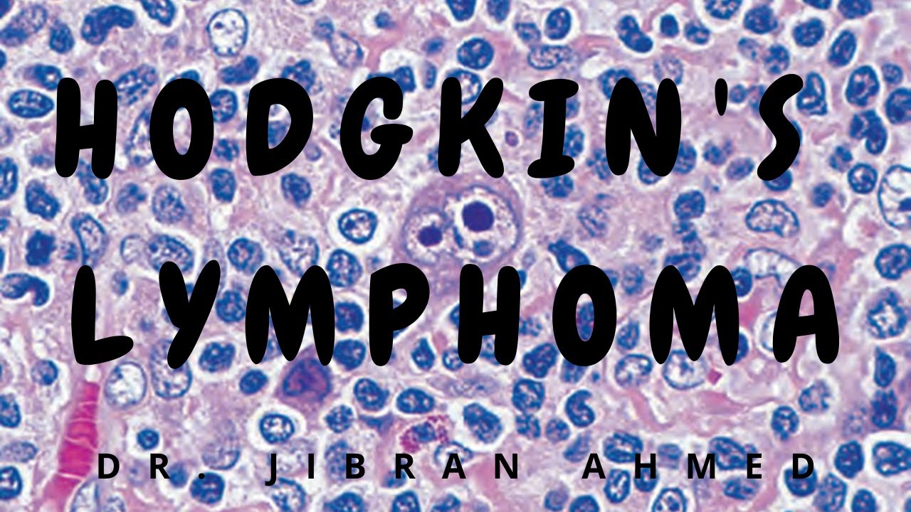 ЛИМФОМА ХОДЖКИНА II РОББИНС 10-Й ЭМИССИИ ГЕМАТОЛОГИИ