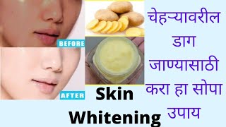 चेहऱ्यावरील डाग जाण्यासाठी घरच्या घरी करा हा सोपा उपायpotato creambeauty homemade youtube Face