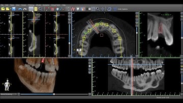 Blue Sky Plan 3 Tutorial: Tangential View