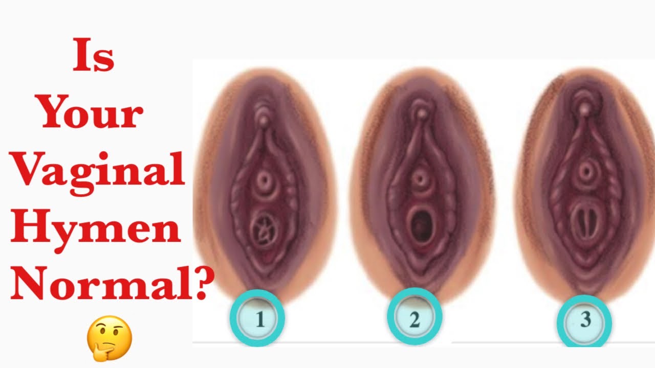 Normal Vaginas