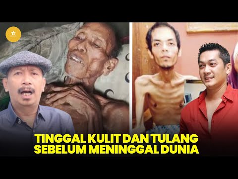 Miris,Tubuh 8 artis ini hanya tinggal kulit dan tulang sebelum meninggal dunia