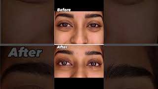 Lash Lift Treatment At Dermakācā Natural Long-Lasting Lash Enhancement In Greater Kailash 1, Delhi