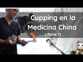 Ventosas ( cupping) en la Medicina China: De la Teoría a la Investigación Moderna ( 7 parte)