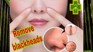 Blackheads & removal acne