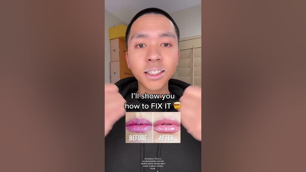 HOW TO FIX DRY/CHAPPED LIPS  INSTANTLY 🤯 #diy #satisfying #shorts