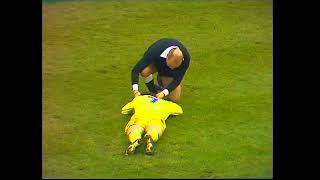 Peter Lorimer Bloodied After Being Punched In The Nose - Chelsea V Leeds United 197374