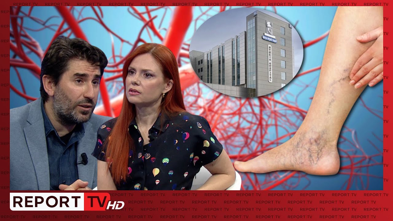 Kujdes me variçet,mund të rrezikoni trompozë! Trajtimi me rezultat në Spitalin 'Hygeia' l Klinika 24