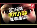 Gözleriniz Doğduğunuzdan Beri Hiç Değişti Mi
