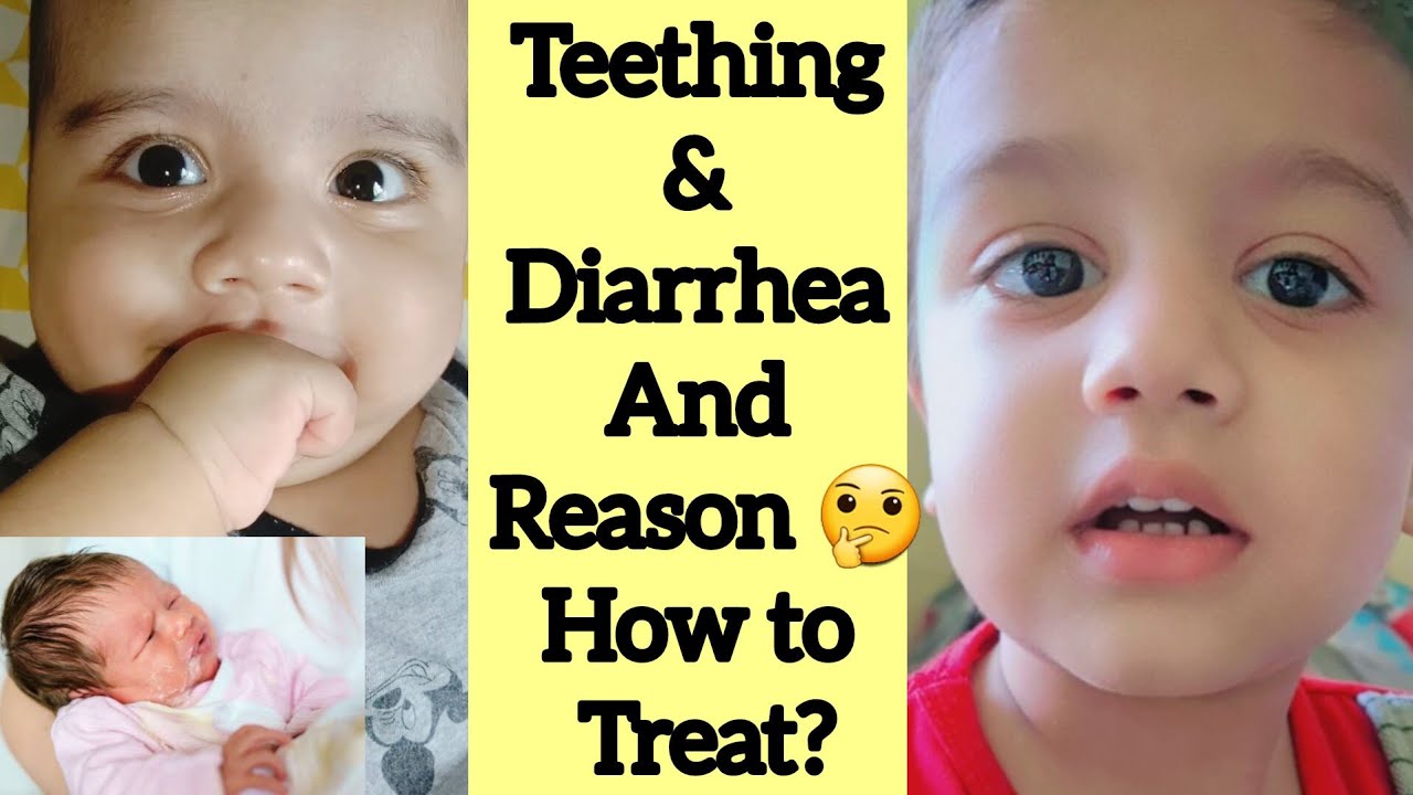 lose-motion-fever-during-teething-in-babies-danto-ki-waja-se-bacho-ko