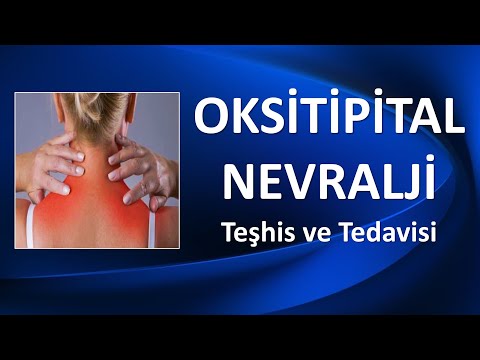 OKSİPİTAL NEVRALJİ