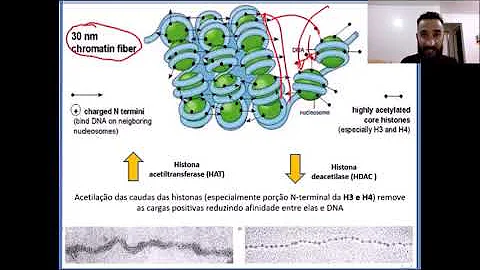 Como se chama a região da cromatina que aparece mais condensada ao microscópio eletrônico?
