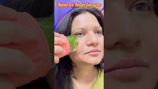 neem ice roller, neem ice cube for face, acne skincare, natural skincare, oily skin remedy #shorts