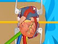 Operate now  heart surgery  play surgery games