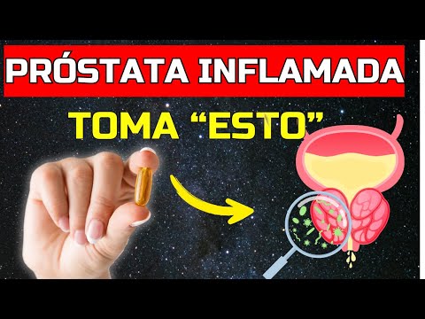 PROSTATA INFLAMADA Descubre CÓMO CURAR la PROSTATITIS AGUDA
