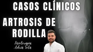 !ARTROSIS DE RODILLA! Tratamiento y mi visión en consulta /Caso Clínico 1 | Fisioterapia Adrià Solà