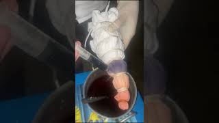 Celebrity Tie-dye bermuda de algodón Wealth