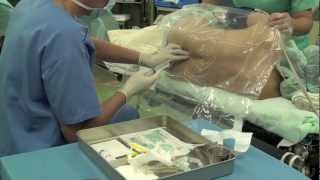 今日の硬膜外麻酔 epidural anesthesia by Dr.EpiCal (Anestesia Peridural)