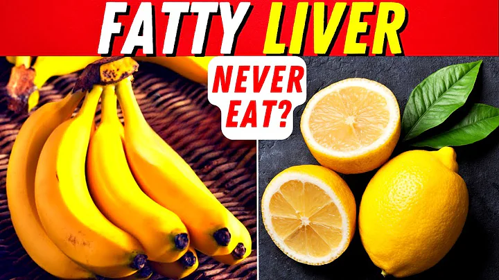 5 Forbidden Foods for Fatty Liver and 10 Best Fruits For Hepatic Steatosis