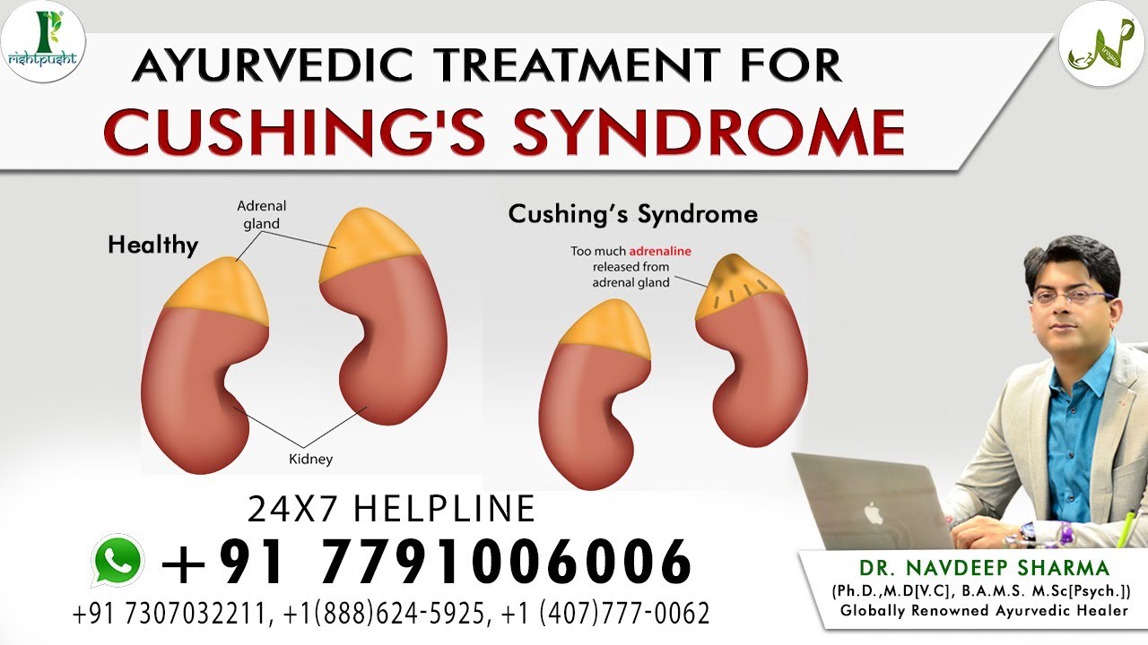 🔴(Live) Ayurvedic Treatment for Cushing's Syndrome Rishtpusht YouTube