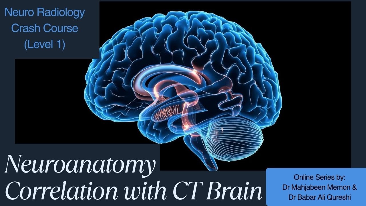 Neuroanatomy Correlation with CT Brain. - YouTube