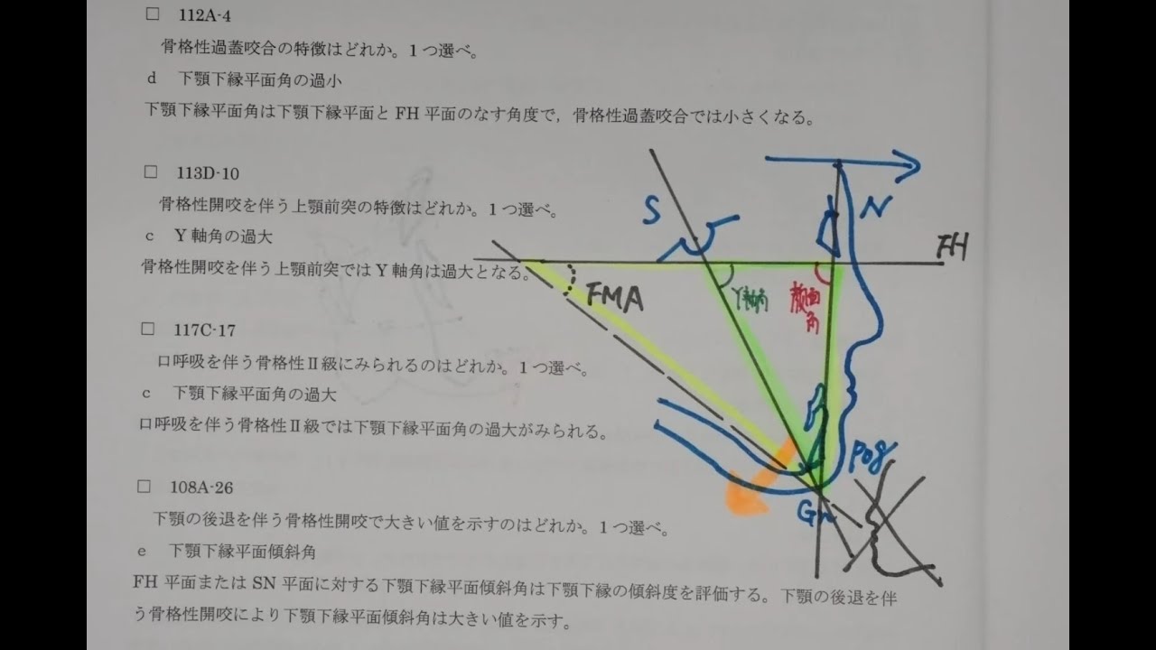 歯科国試対策ワンポイントアップ！必修対策③（矯正） - YouTube