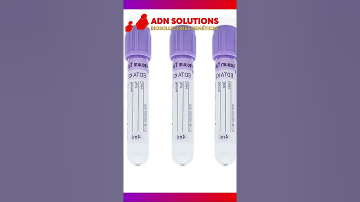 Cómo tomar una Muestra de Sangre para prueba de #adn  #paternidad - ADN SOLUTIONS