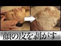 【皮をめくる!?】究極の肌ケアの「ハーブピーリング」をしてきました!