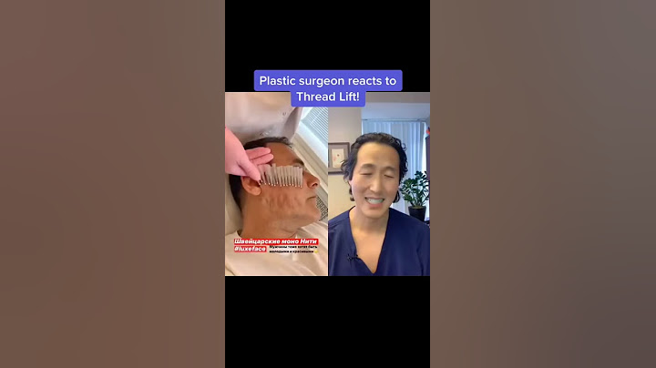 Do Thread Lifts Work? A Plastic Surgeon Reacts! #shorts #threadlifting