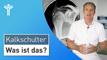 Kann sich Kalk in der Schulter wieder auflösen?