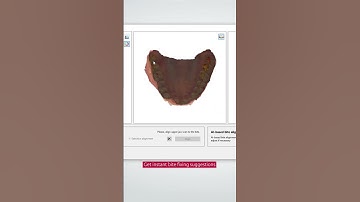 Dental System 2025 introduces AI bite alignment, aligning upper & lower scans in seconds. #3shape