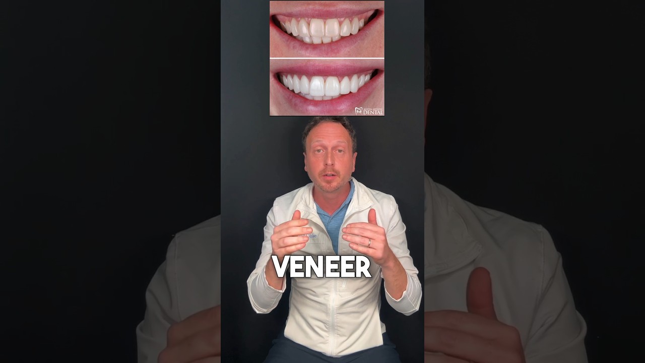 Veneer replacement smile makeover! 