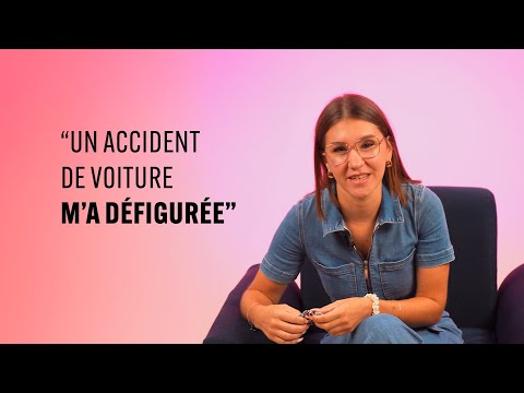 Out Loud - Zellie, a car accident disfigured me
