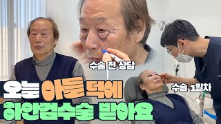 성형외과 의사 아들 덕에 하안검 수술 합니다! 성형 당일 vlog