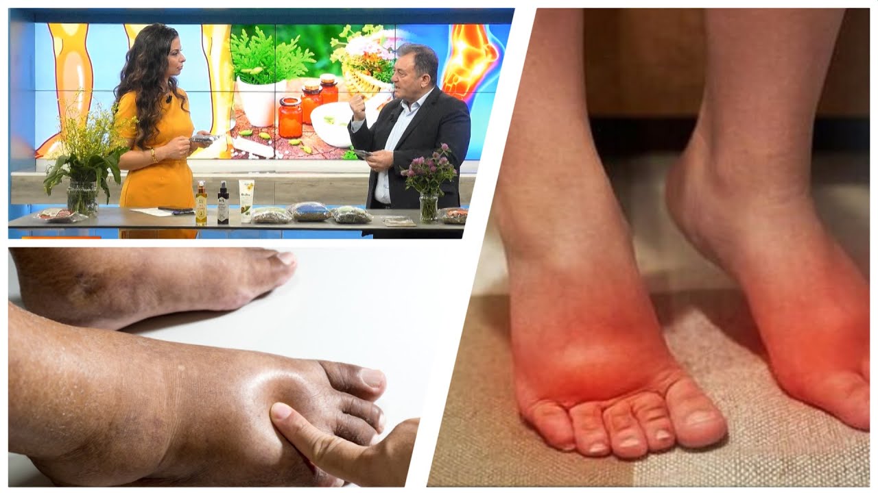 Ju ënjten këmbët? Ja çfarë fshihet pas... / Ylli Merja sjell kurën natyrale