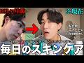【初公開】ニキビ肌から美肌に3ヶ月でなるスキンケアを全部お見せします!