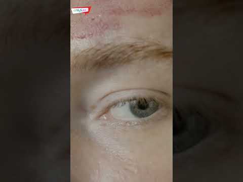 الكسوف الذي يعمي النظر