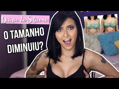 DIÁRIO DO SILICONE #4: 1 MÊS OPERADA